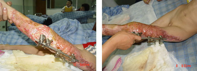 CC网投·(中国游)官方网站