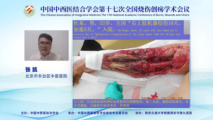 CC网投·(中国游)官方网站