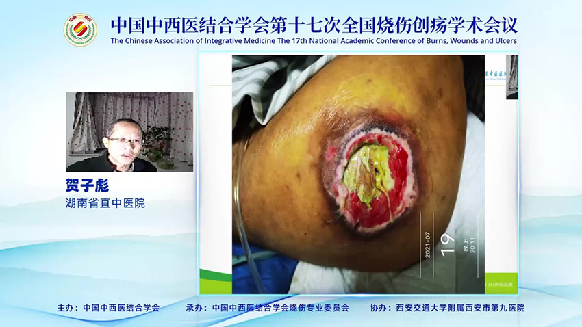 CC网投·(中国游)官方网站