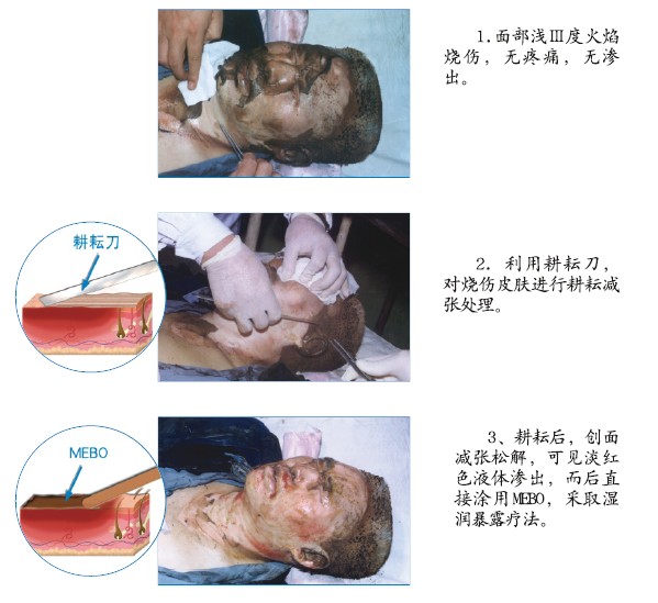 CC网投·(中国游)官方网站