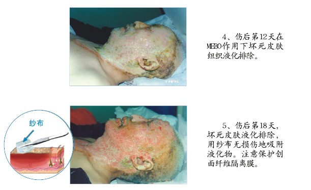 CC网投·(中国游)官方网站