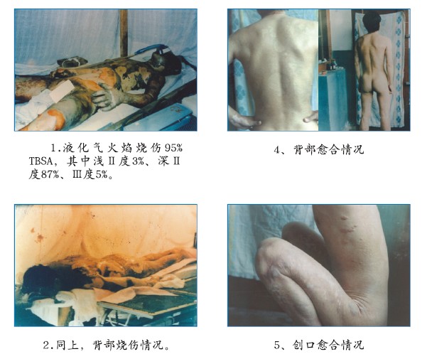 CC网投·(中国游)官方网站